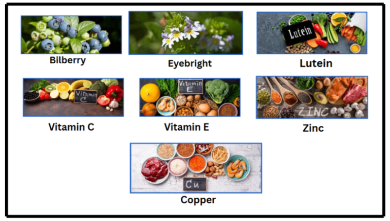 SightFresh supplement honest review for vision support and eye health